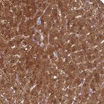 GNPNAT1 Antibody in Immunohistochemistry (Paraffin) (IHC (P))