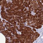 GNPNAT1 Antibody in Immunohistochemistry (Paraffin) (IHC (P))