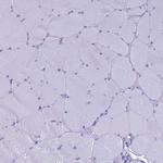 GNPNAT1 Antibody in Immunohistochemistry (Paraffin) (IHC (P))