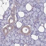 SPDL1 Antibody in Immunohistochemistry (Paraffin) (IHC (P))