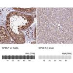 SPDL1 Antibody in Immunohistochemistry (IHC)