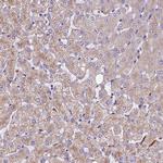 SPDL1 Antibody in Immunohistochemistry (IHC)