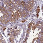 SLC26A10 Antibody in Immunohistochemistry (Paraffin) (IHC (P))