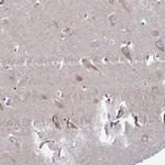 CLCN3 Antibody in Immunohistochemistry (Paraffin) (IHC (P))