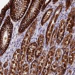 PUS10 Antibody in Immunohistochemistry (IHC)