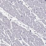 JSRP1 Antibody in Immunohistochemistry (IHC)