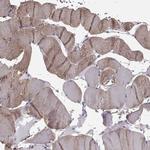 JSRP1 Antibody in Immunohistochemistry (IHC)