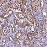 DMRTA1 Antibody in Immunohistochemistry (Paraffin) (IHC (P))