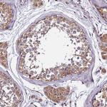 GSPT2 Antibody in Immunohistochemistry (Paraffin) (IHC (P))