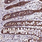 OCIAD1 Antibody in Immunohistochemistry (Paraffin) (IHC (P))