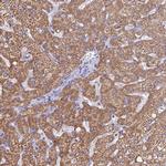 MGST1 Antibody in Immunohistochemistry (IHC)