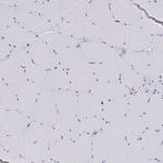 MGST1 Antibody in Immunohistochemistry (IHC)