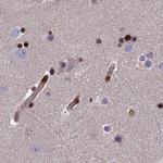 DNPEP Antibody in Immunohistochemistry (IHC)