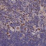 DNPEP Antibody in Immunohistochemistry (IHC)