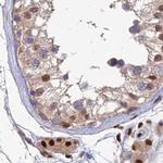 DNPEP Antibody in Immunohistochemistry (IHC)