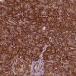 NUDT9 Antibody in Immunohistochemistry (Paraffin) (IHC (P))