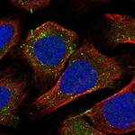 Rabenosyn 5 Antibody in Immunocytochemistry (ICC/IF)