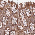 Rabenosyn 5 Antibody in Immunohistochemistry (Paraffin) (IHC (P))