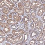 IA-6 Antibody in Immunohistochemistry (Paraffin) (IHC (P))