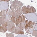 IA-6 Antibody in Immunohistochemistry (Paraffin) (IHC (P))