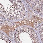 MTERF Antibody in Immunohistochemistry (Paraffin) (IHC (P))