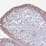 MTERF Antibody in Immunohistochemistry (IHC)