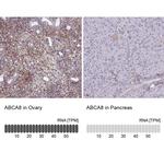 ABCA8 Antibody in Immunohistochemistry (IHC)