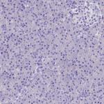 MIIP Antibody in Immunohistochemistry (IHC)