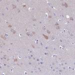 MIIP Antibody in Immunohistochemistry (IHC)