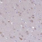 MIIP Antibody in Immunohistochemistry (IHC)