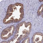 TOMM20L Antibody in Immunohistochemistry (Paraffin) (IHC (P))