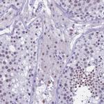 DMRTC2 Antibody in Immunohistochemistry (Paraffin) (IHC (P))