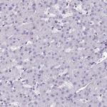 HLA-DOA Antibody in Immunohistochemistry (IHC)