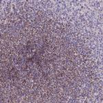 HLA-DOA Antibody in Immunohistochemistry (IHC)