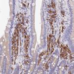 HM13 Antibody in Immunohistochemistry (Paraffin) (IHC (P))