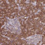 HM13 Antibody in Immunohistochemistry (Paraffin) (IHC (P))