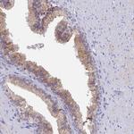 HM13 Antibody in Immunohistochemistry (Paraffin) (IHC (P))