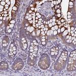 ALG3 Antibody in Immunohistochemistry (Paraffin) (IHC (P))