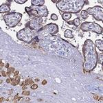 ALG3 Antibody in Immunohistochemistry (Paraffin) (IHC (P))