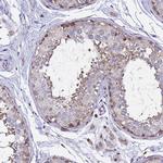 ALG3 Antibody in Immunohistochemistry (Paraffin) (IHC (P))