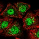 ZMIZ1 Antibody in Immunocytochemistry (ICC/IF)