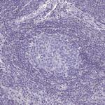 ZMIZ1 Antibody in Immunohistochemistry (Paraffin) (IHC (P))