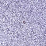 ZMIZ1 Antibody in Immunohistochemistry (Paraffin) (IHC (P))