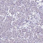 ZMIZ1 Antibody in Immunohistochemistry (Paraffin) (IHC (P))