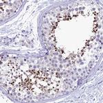 ZMIZ1 Antibody in Immunohistochemistry (Paraffin) (IHC (P))