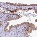 ZMIZ1 Antibody in Immunohistochemistry (IHC)