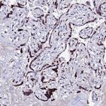 MYNN Antibody in Immunohistochemistry (IHC)