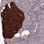 VAT1 Antibody in Immunohistochemistry (Paraffin) (IHC (P))