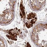 VAT1 Antibody in Immunohistochemistry (Paraffin) (IHC (P))