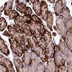 GDF6 Antibody in Immunohistochemistry (Paraffin) (IHC (P))